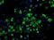 Hydroxysteroid 17-Beta Dehydrogenase 10 antibody, GTX84346, GeneTex, Immunocytochemistry image 