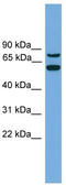 YY1 Associated Protein 1 antibody, TA339793, Origene, Western Blot image 