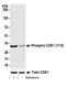 Platelet Derived Growth Factor Receptor Beta antibody, A700-101, Bethyl Labs, Western Blot image 