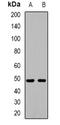 Transforming Growth Factor Beta 1 Induced Transcript 1 antibody, orb382667, Biorbyt, Western Blot image 