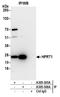 Hypoxanthine-guanine phosphoribosyltransferase antibody, A305-305A, Bethyl Labs, Immunoprecipitation image 