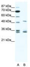 Zinc Finger Protein 488 antibody, TA341504, Origene, Western Blot image 