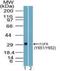 Fibroblast Growth Factor Receptor 1 antibody, NBP2-24462, Novus Biologicals, Western Blot image 