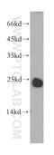 Lysosomal Protein Transmembrane 4 Beta antibody, 18895-1-AP, Proteintech Group, Western Blot image 