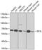 Eukaryotic Translation Initiation Factor 3 Subunit L antibody, 24-005, ProSci, Western Blot image 