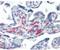 Biogenesis Of Lysosomal Organelles Complex 1 Subunit 6 antibody, NB120-13261, Novus Biologicals, Immunohistochemistry paraffin image 