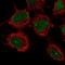 Leucine Rich Repeat Containing 31 antibody, NBP1-93932, Novus Biologicals, Immunocytochemistry image 