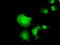 Chromosome 16 Open Reading Frame 72 antibody, LS-C115483, Lifespan Biosciences, Immunofluorescence image 