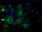 Phosphodiesterase 2A antibody, TA502349, Origene, Immunofluorescence image 