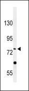 Phospholipase A2 Group VI antibody, LS-C163764, Lifespan Biosciences, Western Blot image 