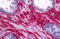 Collagen Type I Alpha 1 Chain antibody, MBS246281, MyBioSource, Immunohistochemistry paraffin image 