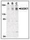 Mitogen-Activated Protein Kinase Kinase Kinase 5 antibody, LS-B3205, Lifespan Biosciences, Western Blot image 