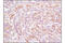 Yes Associated Protein 1 antibody, 8418S, Cell Signaling Technology, Immunohistochemistry paraffin image 