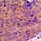 DDX19B antibody, LS-C368888, Lifespan Biosciences, Immunohistochemistry paraffin image 
