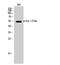 ETS Proto-Oncogene 1, Transcription Factor antibody, STJ91038, St John