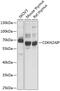 CDKN2A Interacting Protein antibody, 19-003, ProSci, Western Blot image 