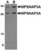 Nipsnap Homolog 3A antibody, A14892, Boster Biological Technology, Western Blot image 