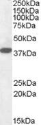 NUAK Family Kinase 1 antibody, 42-035, ProSci, Western Blot image 