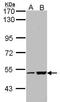 EF-Hand Calcium Binding Domain 14 antibody, TA308984, Origene, Western Blot image 