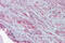 Slo1 antibody, ARP35092_P050, Aviva Systems Biology, Immunohistochemistry paraffin image 