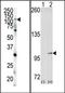 EPH Receptor A4 antibody, AP14278PU-N, Origene, Western Blot image 