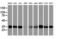 Proteasome Subunit Alpha 6 antibody, LS-C174612, Lifespan Biosciences, Western Blot image 