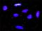 Platelet-derived growth factor subunit A antibody, H00005154-D01P, Novus Biologicals, Proximity Ligation Assay image 