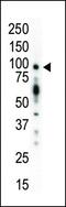 Protein Kinase D1 antibody, GTX25283, GeneTex, Western Blot image 