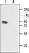 Transient Receptor Potential Cation Channel Subfamily V Member 1 antibody, TA328739, Origene, Western Blot image 