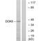 Docking Protein 6 antibody, A13411, Boster Biological Technology, Western Blot image 