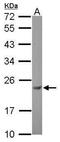 Casein kinase II subunit beta antibody, PA5-29703, Invitrogen Antibodies, Western Blot image 