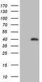 Zinc Finger FYVE-Type Containing 1 antibody, CF810160, Origene, Western Blot image 