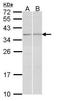 TGFB Induced Factor Homeobox 2 antibody, GTX108069, GeneTex, Western Blot image 