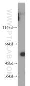 Gamma-PAK antibody, 19979-1-AP, Proteintech Group, Western Blot image 