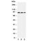 Fibroblast Activation Protein Alpha antibody, R31013, NSJ Bioreagents, Western Blot image 
