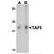 SS-A antibody, TA349026, Origene, Western Blot image 