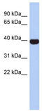 Neuronal Differentiation 4 antibody, TA330528, Origene, Western Blot image 