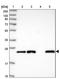 Glutathione S-transferase Mu 5 antibody, NBP2-14074, Novus Biologicals, Western Blot image 