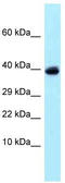 Ubiquitin carboxyl-terminal hydrolase 4 antibody, TA343260, Origene, Western Blot image 