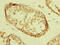 Zinc Finger And BTB Domain Containing 32 antibody, CSB-PA897538LA01HU, Cusabio, Immunohistochemistry paraffin image 