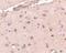 BRCA1/BRCA2-Containing Complex Subunit 3 antibody, PA5-20426, Invitrogen Antibodies, Immunohistochemistry paraffin image 