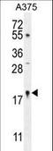 Small Nuclear Ribonucleoprotein U4/U6.U5 Subunit 27 antibody, LS-C161347, Lifespan Biosciences, Western Blot image 