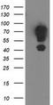 E3 ubiquitin-protein ligase MGRN1 antibody, CF502680, Origene, Western Blot image 