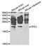 Trefoil Factor 3 antibody, MBS129890, MyBioSource, Western Blot image 