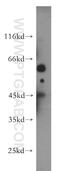 Homocysteine Inducible ER Protein With Ubiquitin Like Domain 1 antibody, 10813-1-AP, Proteintech Group, Western Blot image 