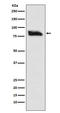 SMAD Specific E3 Ubiquitin Protein Ligase 2 antibody, M02585, Boster Biological Technology, Western Blot image 