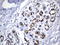hMSH6 antibody, UM870148, Origene, Immunohistochemistry paraffin image 