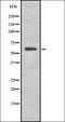 NPC1 Like Intracellular Cholesterol Transporter 1 antibody, orb337281, Biorbyt, Western Blot image 