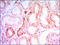 Parathyroid Hormone 1 Receptor antibody, M01588-1, Boster Biological Technology, Immunohistochemistry paraffin image 