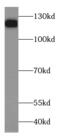 HD5 antibody, FNab03802, FineTest, Western Blot image 